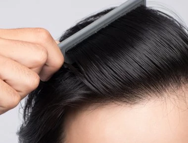 Αραίωση στα μαλλιά- Πότε είναι σημάδι για κάτι σοβαρό